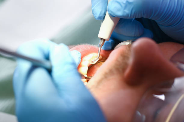 Best Emergency Gum Pain Relief  in Ransom Canyon, TX